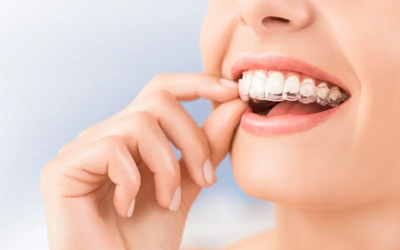 Does Medicaid Cover Invisalign?